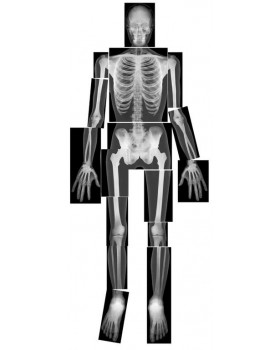 Radiografii ale scheletului uman